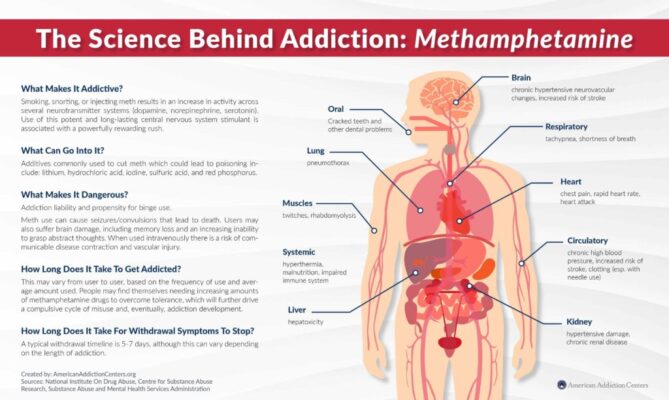 Methamphetamine addiction