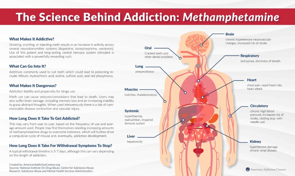 Methamphetamine addiction